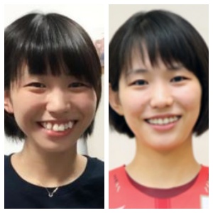 画像 古賀紗理那の顔が変わった 歯列矯正で綺麗になった歯並びを比較検証 ソロモンnews