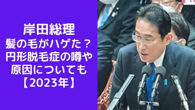 岸田総理ハゲてる