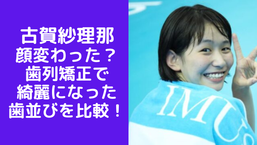 【画像】古賀紗理那の顔が変わった？歯列矯正で綺麗になった歯並びを比較検証！